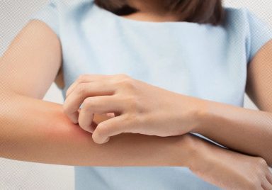 7 recommended blood and diagnostic tests for long-term itching problem