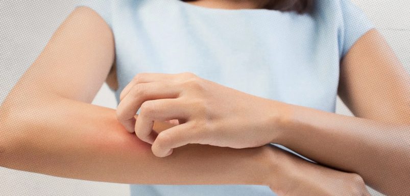 7 recommended blood and diagnostic tests for long-term itching problem