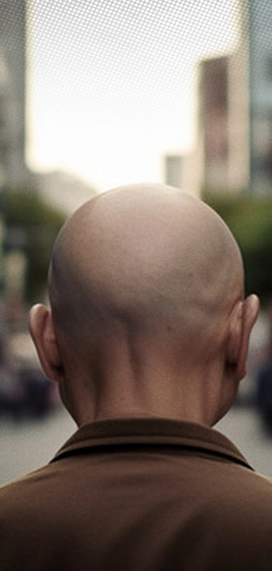 Where do men go bald the most in Asia?