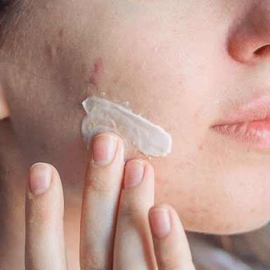 Is it true that toothpaste is an effective spot treatment?