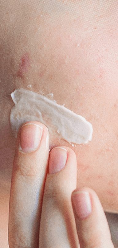 Is it true that toothpaste is an effective spot treatment?